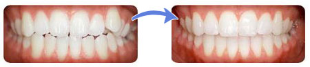 Ortodonti2